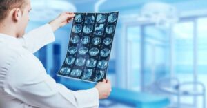 Inteligência Artificial é mais confiável que médicos em diagnósticos